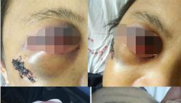 快訊 | 華潤水泥分廠發(fā)生事故?。ǜ綀D）